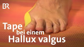 Was tun beim Ballenzeh  Tape bei einem Hallux valgus  Anleitung  Fußpflege  Ballen [upl. by Docia]