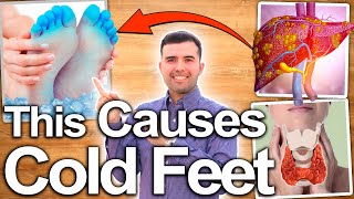 REVEALED 5 REASONS WHY YOU HAVE COLD FEED  Causes and Natural Solutions for Cold Feet [upl. by Negiam]