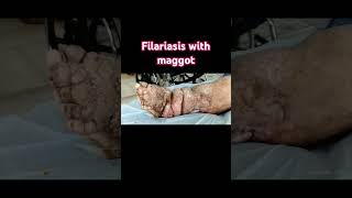 Filariasis with maggot [upl. by Haag]