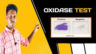 Oxidase Test AZ  in Bangla video [upl. by Bob596]