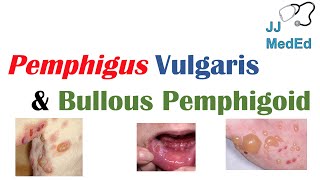 Vesiculobullous Skin Diseases  Pemphigus Vulgaris vs Bullous Pemphigoid [upl. by Naesad]