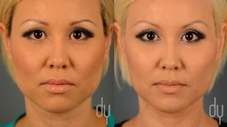 BOTOX® for Masseter Reduction  Before  After  Jaw Reduction  Tapering Reviews  Beverly Hills [upl. by Philbo]