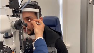 Keratoconus treatment One Week follow up after Corneal Crosslinking CXL Live footage [upl. by Ttenaej]