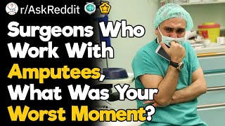 Amputation Surgeons What Was Your Worst quotOh Crapquot Moment [upl. by Kally241]