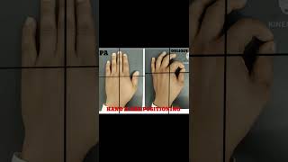 Hand x ray positioning short video [upl. by Dennison417]