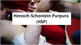 HenochSchonlein Purpura HSP [upl. by Knoll]