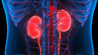 Acute kidney injury AKI [upl. by Dee Dee]