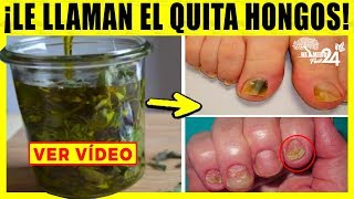 DILE ADIOS A LOS HONGOS EN LAS UÑAS CON UNAS GOTAS DE OREGANO [upl. by Otha]