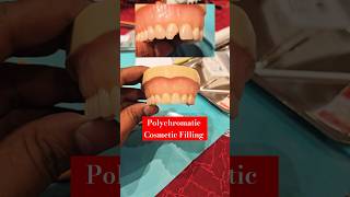 Polychromatic Cosmetic Composite Filling Workshop attended  Cosmetic Dentist Doc Taj dentist [upl. by Aniakudo]