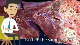 Is Pulmonary Fibrosis the same as Idiopathic Pulmonary Fibrosis [upl. by Iyre341]