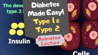 Diabetes Type One amp Two whats the difference [upl. by Erdied]