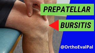 Prepatellar Bursitis Anterior knee pain and swelling [upl. by Ramled]