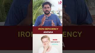 😊Iron Deficiency Anemia irondeficiency anemia unhealthyfood anemiaawareness [upl. by Rriocard]