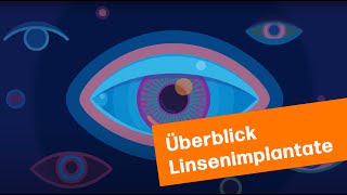 Überblick Linsenimplantate  MUNICH EYE [upl. by Brendan391]