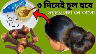 তিন দিনেই চুল লম্বা ঘন কালো হবে চুল পড়া বন্ধ হবেfast hair growth remedyHair Regrowth [upl. by Canotas84]