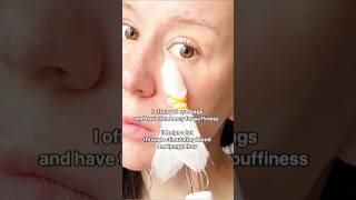 High frequency facialskintreatmentdarsonvalbeautyacnefacialbacktoschoolskincareroutineacne [upl. by Hayikaz237]