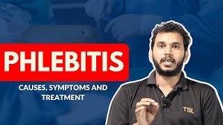 Learn What are the Causes Symptoms and Treatment of Phlebitis  TSL Tarun Saini Lectures [upl. by Johnston]