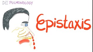 today discussion about the epistaxis knowledge nursingofficer notesmaking epistaxis [upl. by Hsreh]