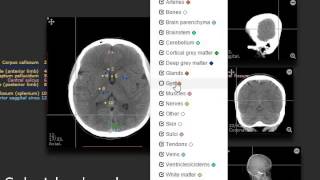 ImagingAnatomycom  CT Cerebrum  Part 2 [upl. by Llehcar]