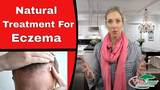 Eczema  Natural Treatment for Eczema  VitaLife Show 143 [upl. by Arvind]