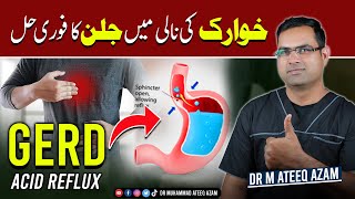 1 Best way to treat Acid Reflux disease GERD [upl. by Hsemar]