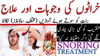 SNORING TREATMENT  Stop Snoring permanently  kharraton ka ilaaj Causes of snoring [upl. by Nirtiac949]