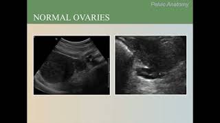 Ultrasound Training Course 07 part 2 [upl. by Rey]