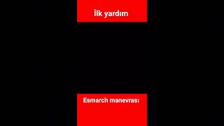 İlk yardım esmarch manevrası [upl. by Lederer]