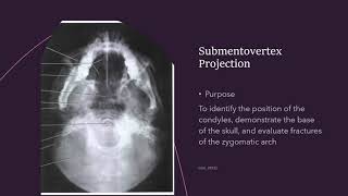 Extraoral Radiography [upl. by Amlet140]