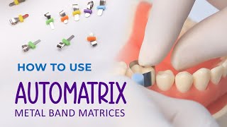 How to use Automatrix Metal Band Matrices [upl. by Nappie]