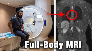 I Did a 2500 Prenuvo MRI Scan My Surprising Results [upl. by Annitsirhc141]