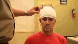 Bandaging Head Bandage [upl. by Erdeid]