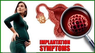 Implantation Symptoms – Top 7 Early Signs and Symptoms of Implantation [upl. by Ainegul]