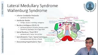 Medulla Lesions [upl. by Aloke909]