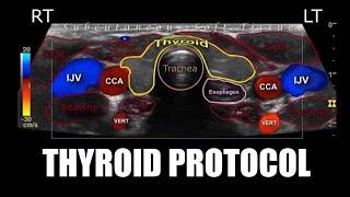 Sonoquickies  Thyroid Ultrasound Protocol [upl. by Yelad]