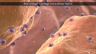 BioCartilage® Cartilage Extracellular Matrix [upl. by Xela]