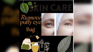 চোখের নিচের ফোলা দুর করার টিপ্স।।Remove eye Bag and puffy eye।। Bengligirlskincaretips। skincare [upl. by Nevin]