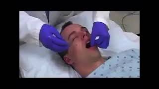 How to insert an Oropharyngeal Airway360P [upl. by Airretal]