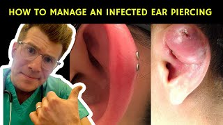 How to recognise manage and treat an infected ear piercing  Doctor ODonovan explains [upl. by Pollerd]