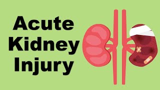 Acute Kidney Injury AKI  causes and management [upl. by Ellevel]