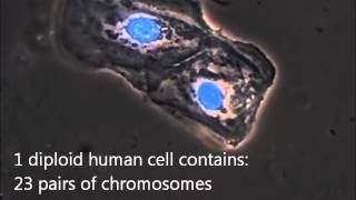 A microscopic view of a buccal swab sample for DNA analysis [upl. by Erotavlas448]