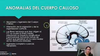 Malformaciones congénitas del Cerebro [upl. by Ledarf802]