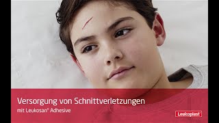 Versorgung von Schnittverletzungen mit Leukosan® Adhesive [upl. by Olrak]