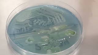 Lactose fermenting colonies of Raoultella ornithinolytica became Nonlactose fermenting after old [upl. by Elletnahs]