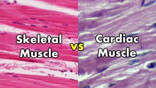 Differentiating Skeletal Muscle and Cardiac Muscle  Striations vs Intercalated Discs [upl. by Crist]