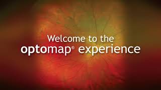 Optomap Comparision [upl. by Aseiram]