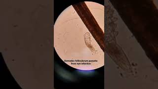 Microscopic examination of Demodex folliculorum in hair follicles [upl. by Enilehcim]