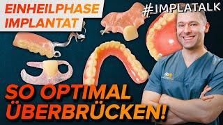 Provisorium nach Implantation  So überstehst du die Einheilphase optimal [upl. by Akciret]