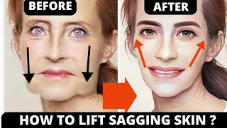 🛑 SIMPLE STEP TO LIFT SAGGING SKIN JOWLS ANTIAGING CHEEKS LIFT  LAUGH LINES FOREHEAD LINES [upl. by Eiclehc]