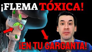 FLEMA TÓXICA en TU GARGANTA ¡ELIMÍNALA INMEDIATAMENTE [upl. by Darrin]